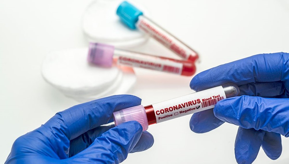 23 Aralık 2021 corona virüs tablosu: 168 can kaybı, 18 bin 771 yeni vaka
